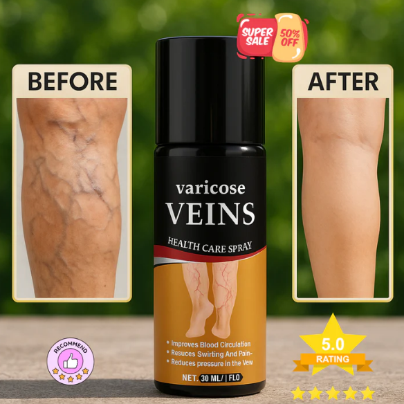 Turmeric Varicose Vein Relief Spray | Buy 1 Get 1 FREE ⭐⭐⭐⭐⭐ (41,876 Customer Reviews)