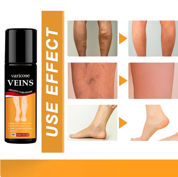 Turmeric Varicose Vein Relief Spray | Buy 1 Get 1 FREE ⭐⭐⭐⭐⭐ (41,876 Customer Reviews)
