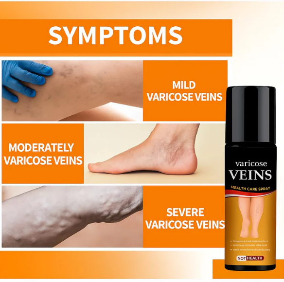 Turmeric Varicose Vein Relief Spray | Buy 1 Get 1 FREE ⭐⭐⭐⭐⭐ (41,876 Customer Reviews)